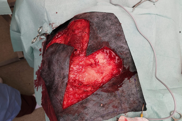 Ben Rice Middle Of Surgery